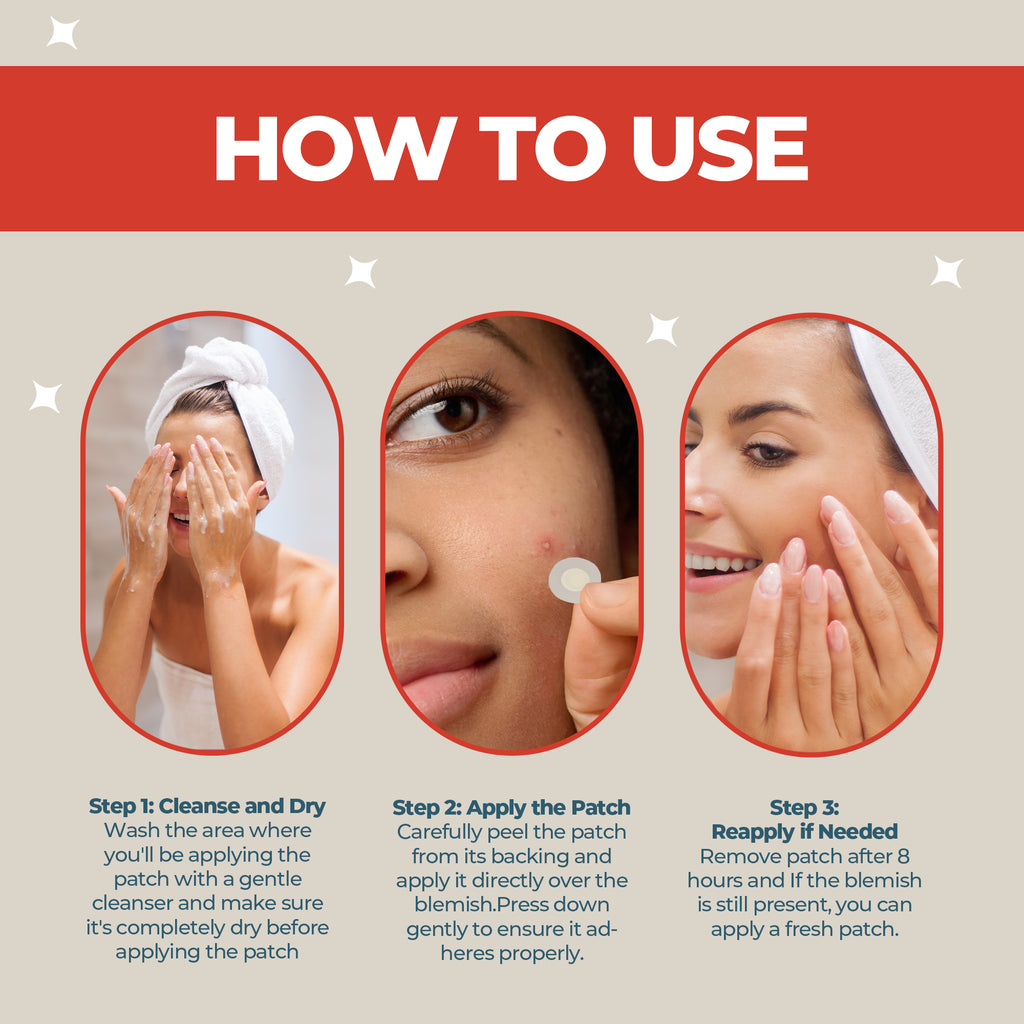 Microneedle Spot Patch - Advanced Blemish Treatment Infused with Tea Tree, Madecassoside, Salicylic Acid & Hyaluronic Acid